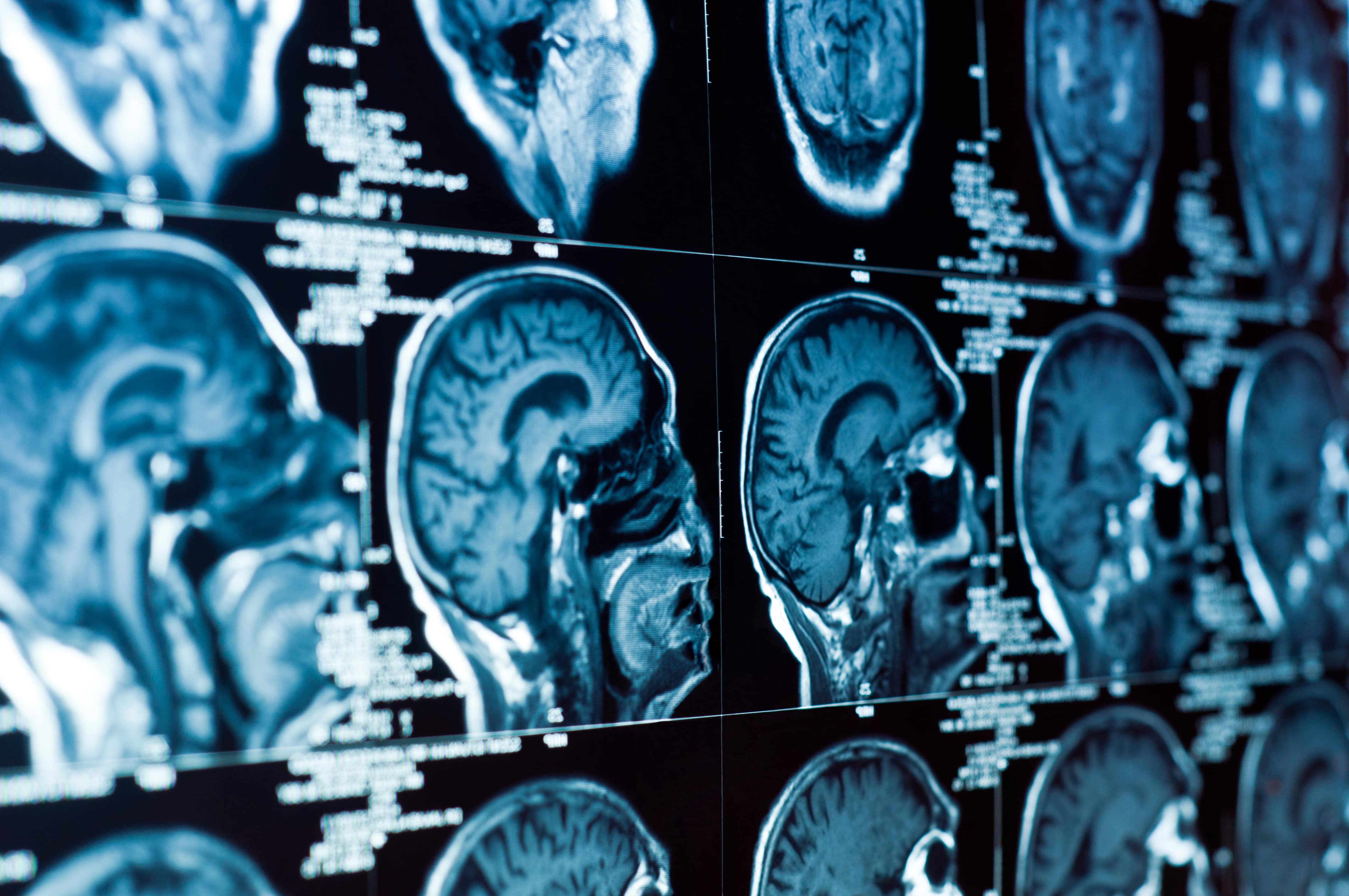 Demystifying MRI: The World Of Medical Imaging